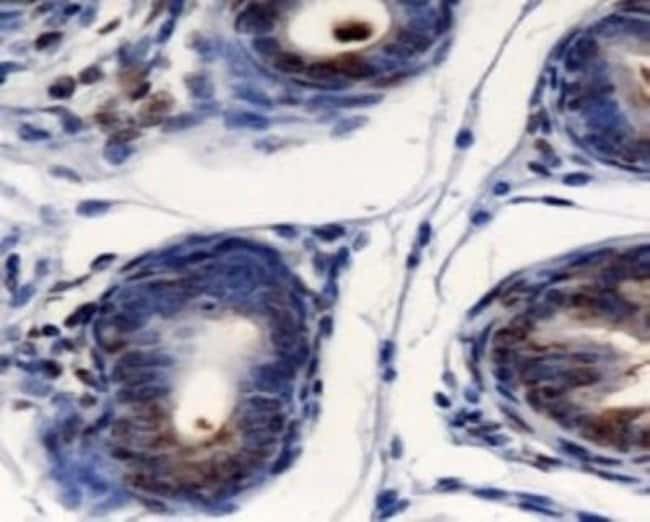 AGR2 Polyclonal Antibody, 100 µl