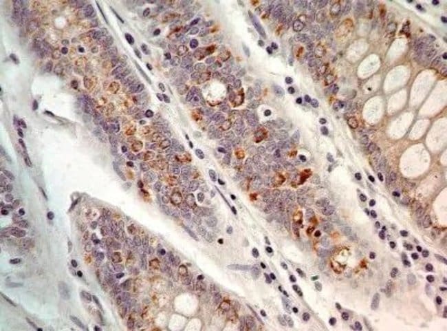 AGR2 Polyclonal Antibody, 100 µg