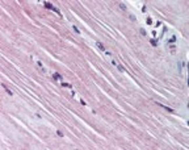 AMPDA1 Polyclonal Antibody, 100 µg