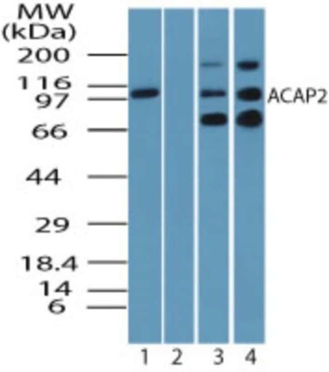 ACAP2 Polyclonal Antibody, 100 µg