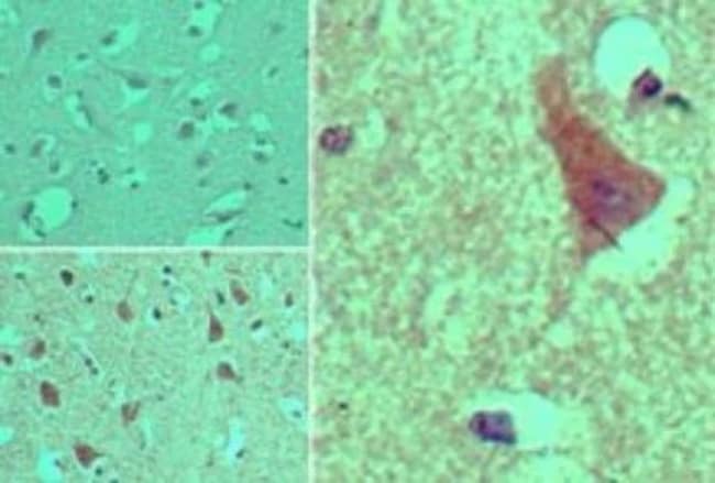 AGAP2 Polyclonal Antibody, 100 µg