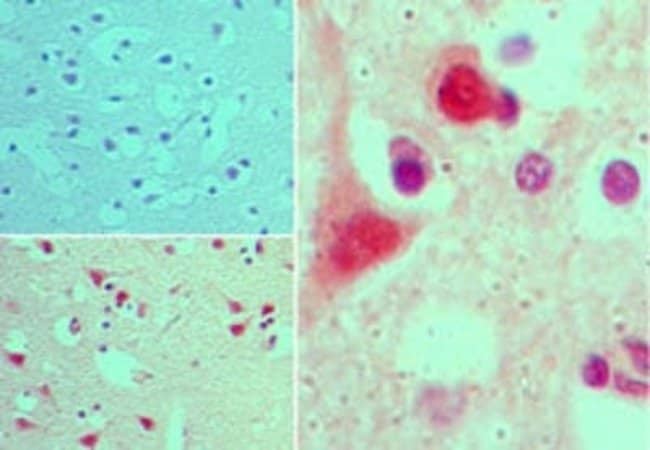 AGAP2 Polyclonal Antibody, 100 µg