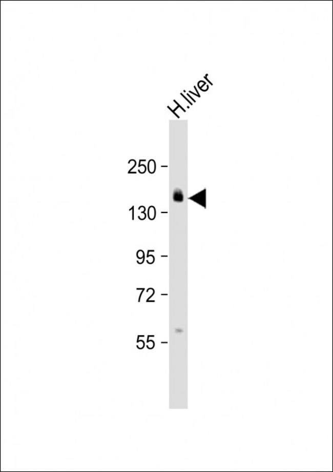AEBP1 Polyclonal Antibody, 100 µg