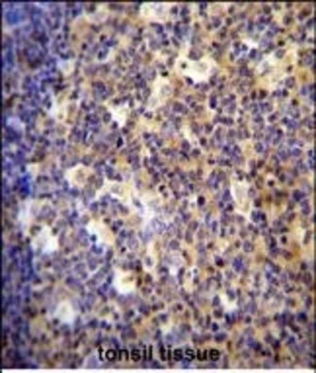 ALOX12B Polyclonal Antibody, 100 µg