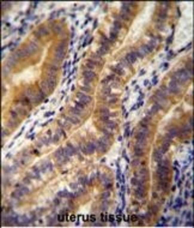 ANGPT2 Polyclonal Antibody, 100 µg
