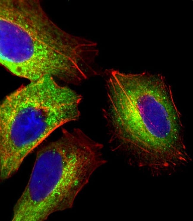 AHSG Polyclonal Antibody, 100 µg