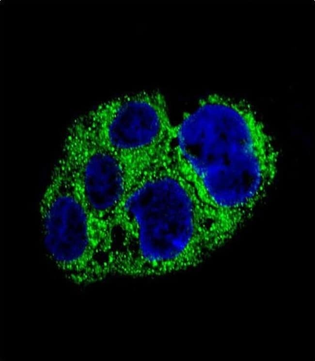 AMACR Polyclonal Antibody, 100 µg