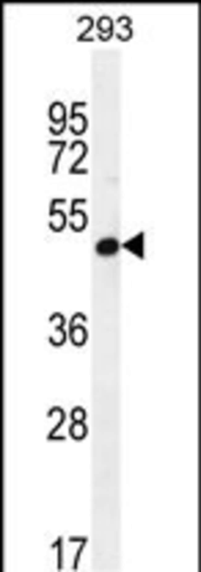 A4GALT Polyclonal Antibody, 100 µg