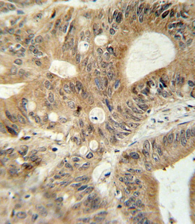 ABCC3 Polyclonal Antibody, 100 µg