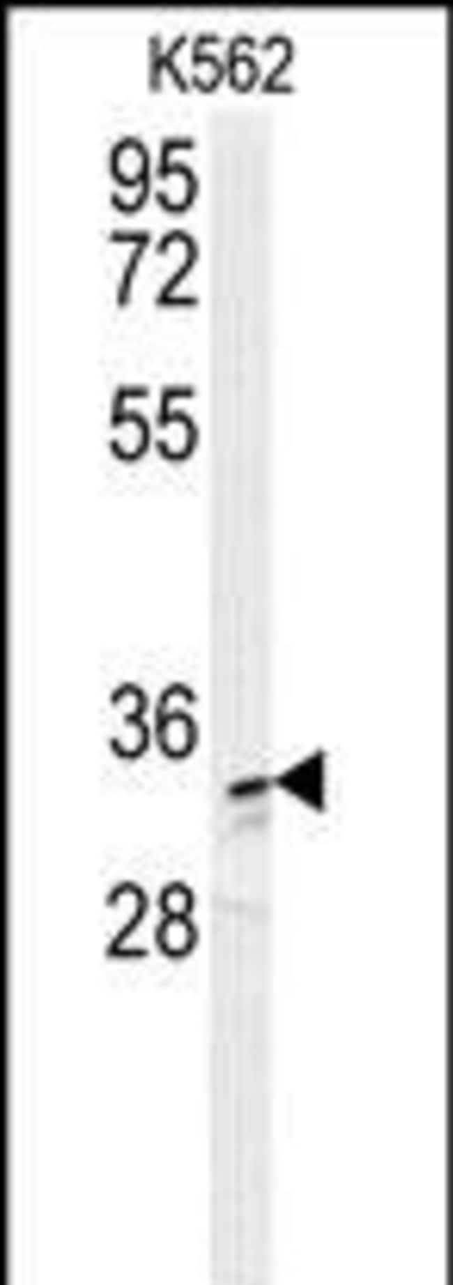 AKR1C3 Polyclonal Antibody, 100 µg