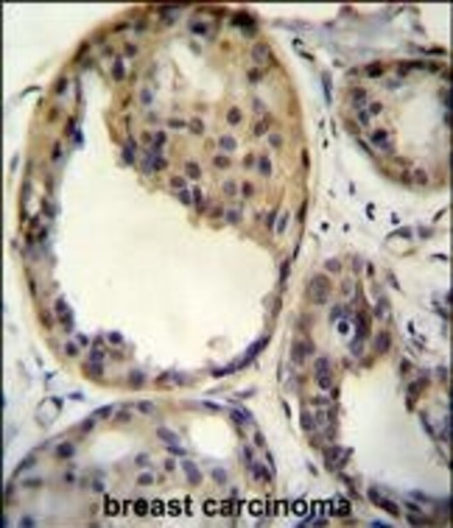 AKT1 Polyclonal Antibody, 100 µg