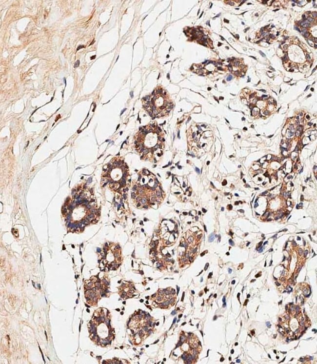 ALOXE3 Polyclonal Antibody, 100 µg