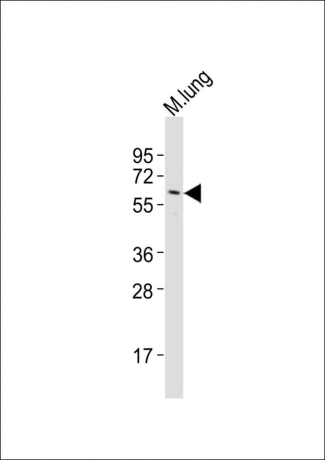ANGPT1 Polyclonal Antibody, 100 µg
