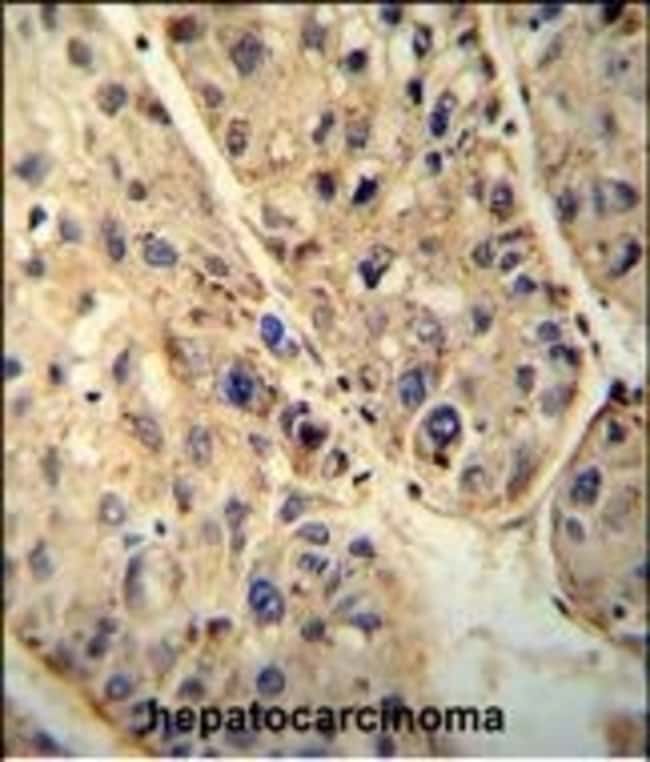 ABCD1 Polyclonal Antibody, 100 µg