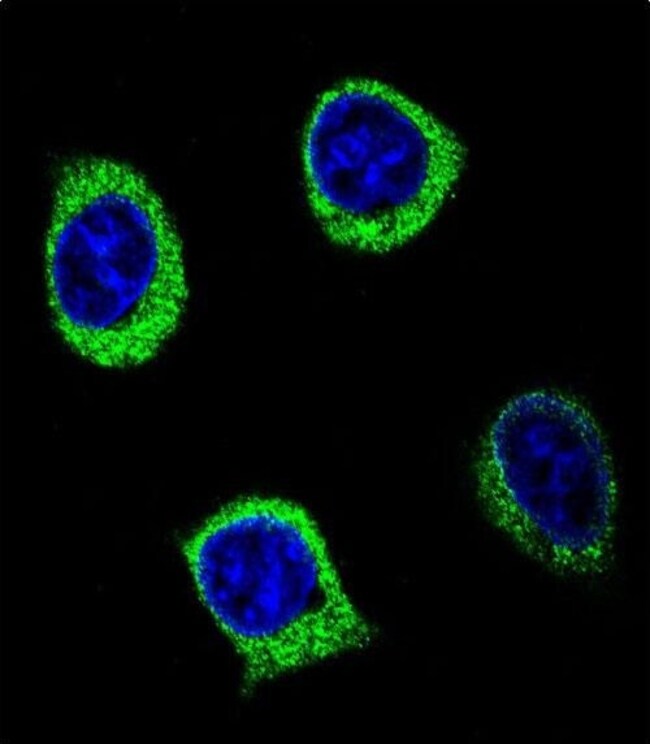 AMY2B Polyclonal Antibody, 100 µg