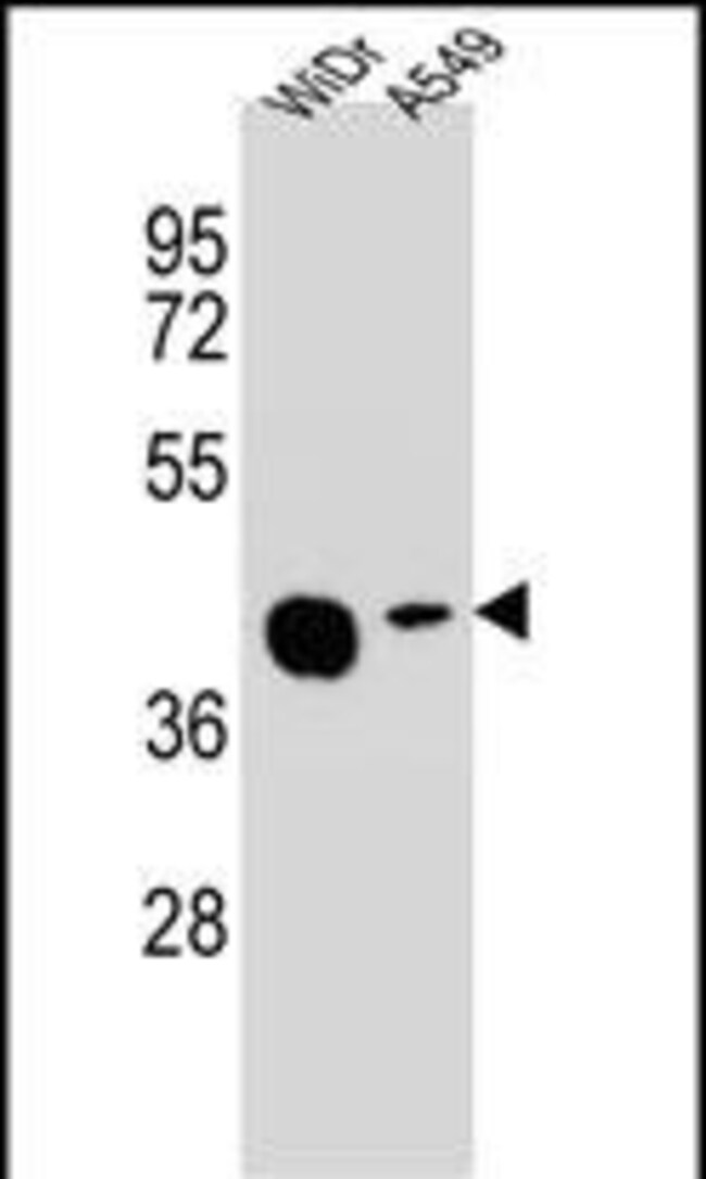 AMAC1L2 Polyclonal Antibody, 100 µg