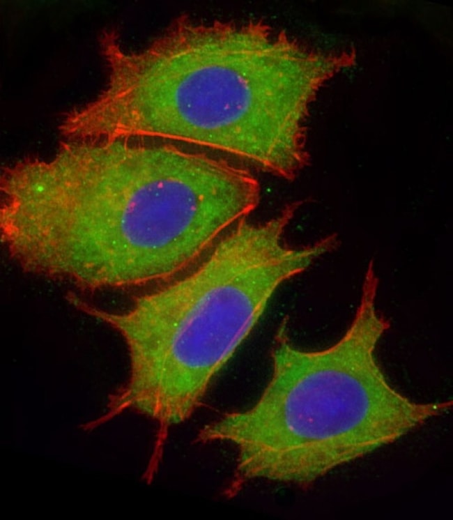 400ul CFH POLYCLONAL ANTIBODY