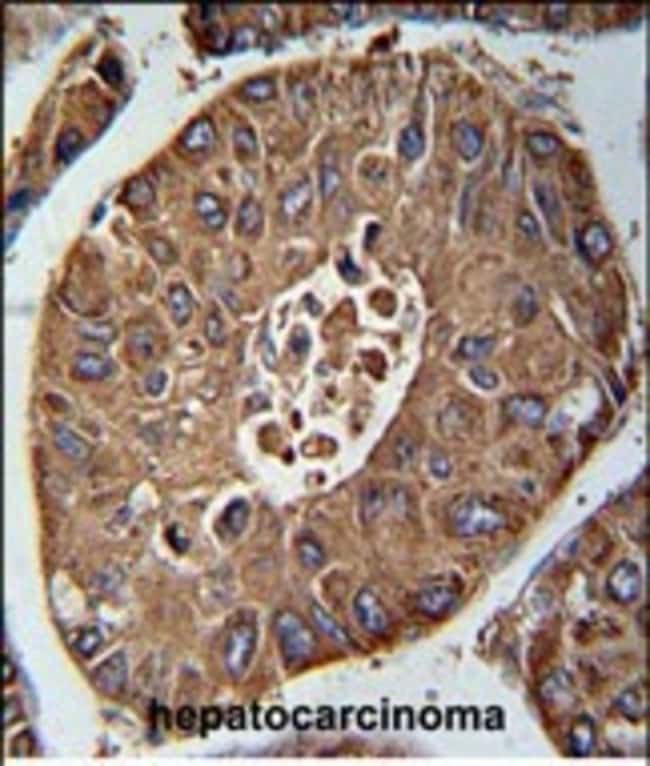 ACN9 Polyclonal Antibody, 100 µg