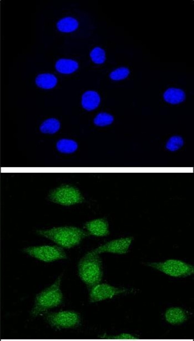 AIRE Polyclonal Antibody, 100 µg