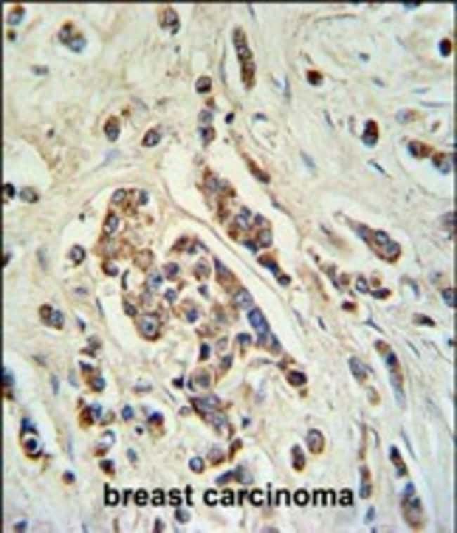 ABCC11 Polyclonal Antibody, 100 µg
