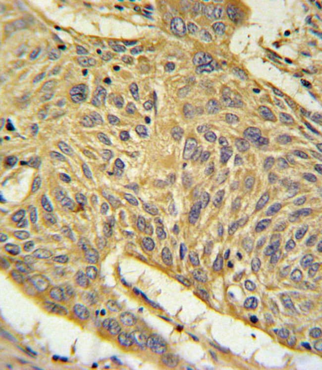 AGER Polyclonal Antibody, 100 µg