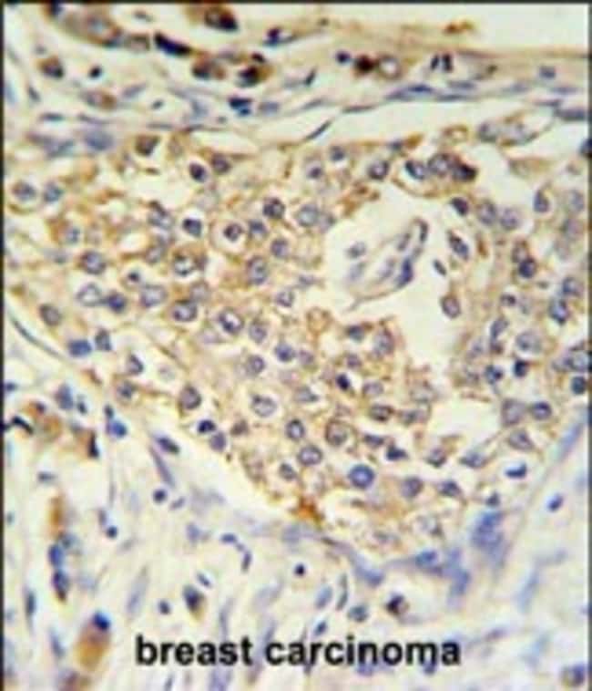 ADFP Polyclonal Antibody, 100 µg