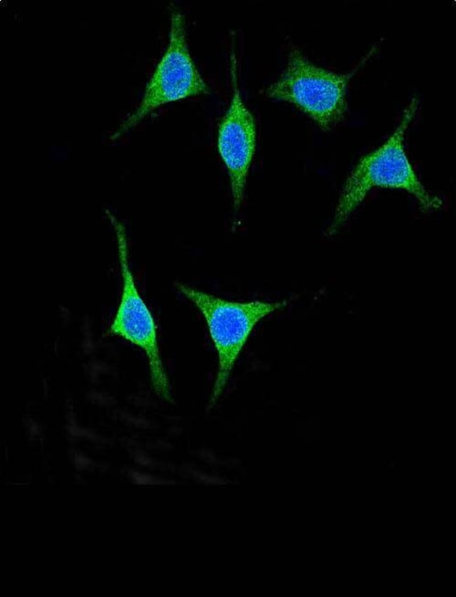 AMY2A Polyclonal Antibody, 100 µg