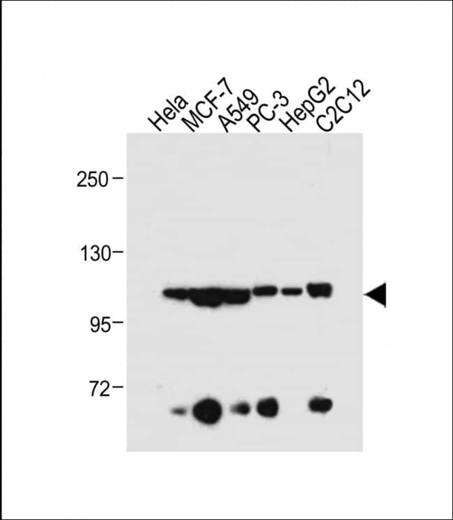 AHR Polyclonal Antibody, 100 µg