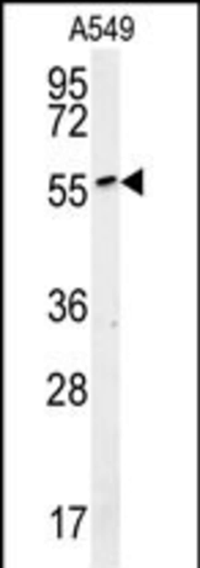 ALG10B Polyclonal Antibody, 100 µg