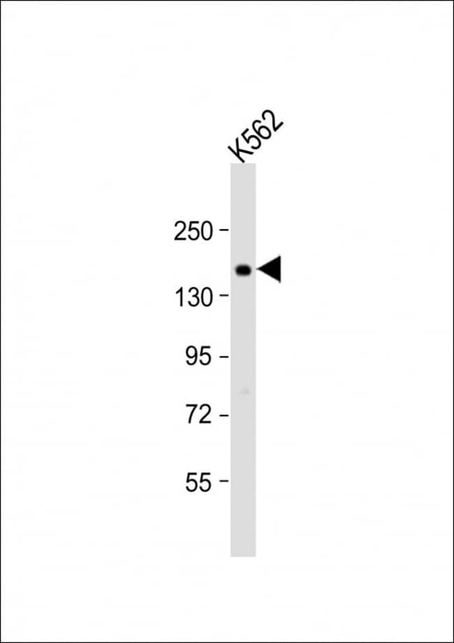 ADCY10 Polyclonal Antibody, 100 µg