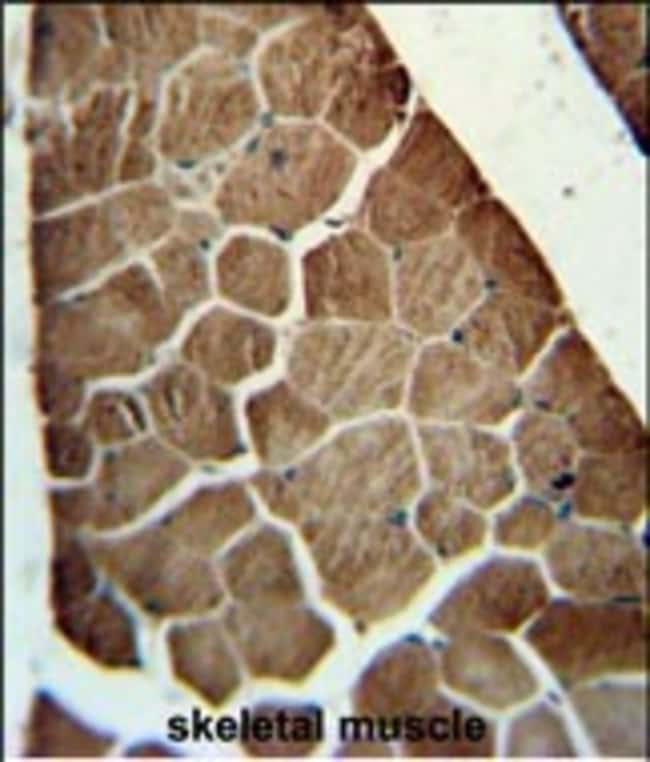 ADSSL1 Polyclonal Antibody, 100 µg