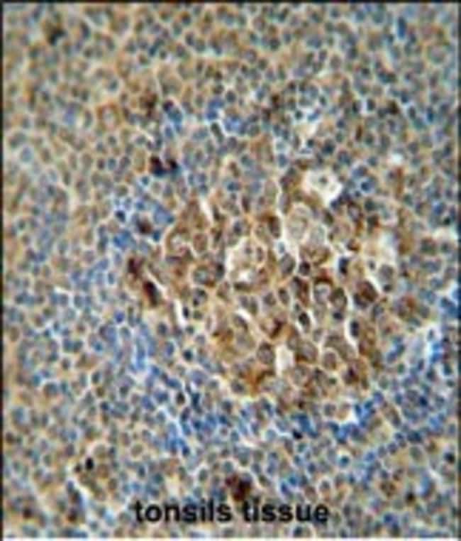 ACSF3 Polyclonal Antibody, 100 µg