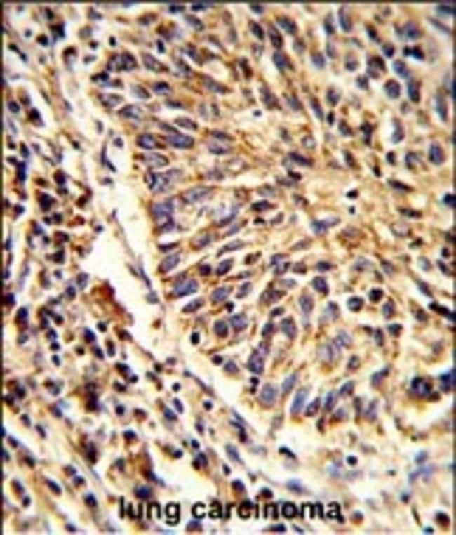 ADAM9 Polyclonal Antibody, 100 µg