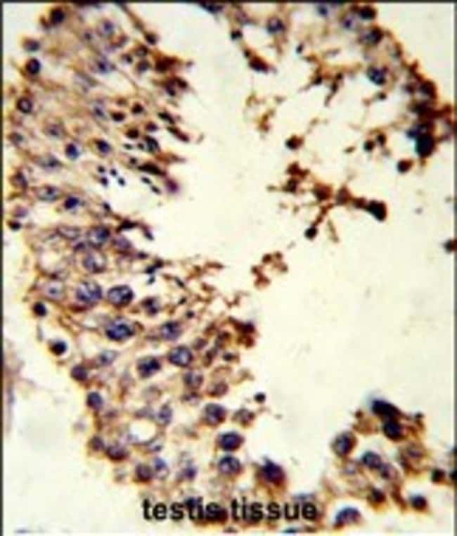 ACR Polyclonal Antibody, 100 µg