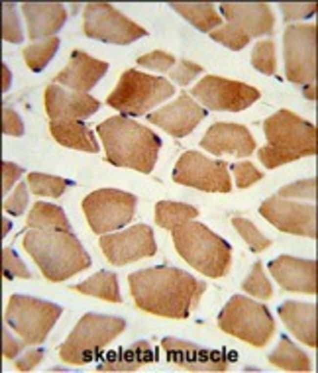 AMPD2 Polyclonal Antibody, 100 µg