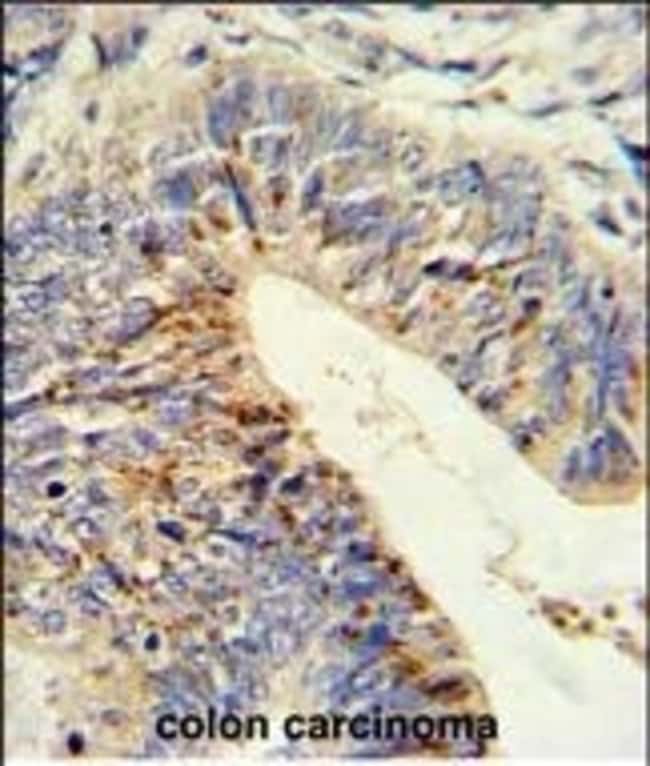 ADAMDEC1 Polyclonal Antibody, 100 µg