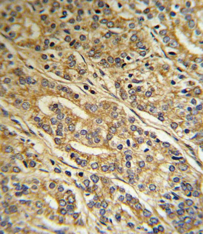 ACOT8 Polyclonal Antibody, 100 µg
