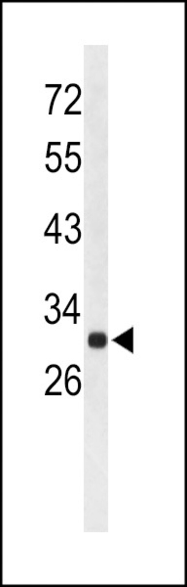 AFMID Polyclonal Antibody, 100 µg