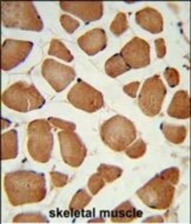 100 µg ANGPTL4 Polyclonal Antibody