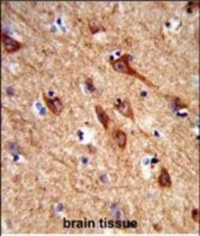 ACCN1 Polyclonal Antibody, 100 µg