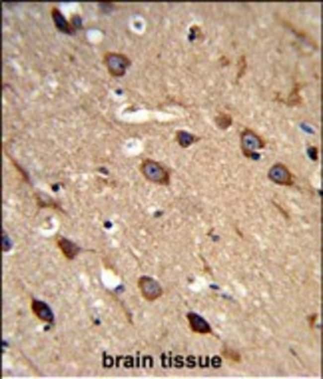ACCN2 Polyclonal Antibody, 100 µg