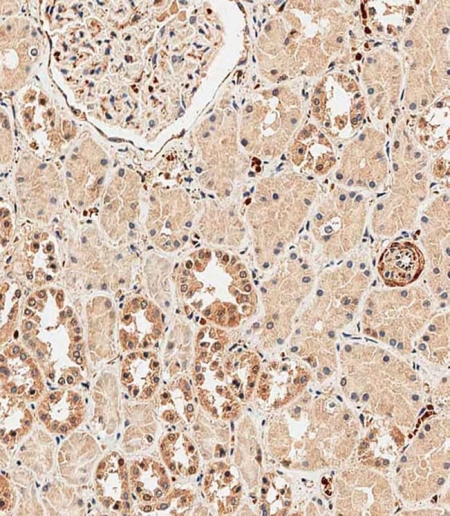 ABCF1 Polyclonal Antibody, 100 µg