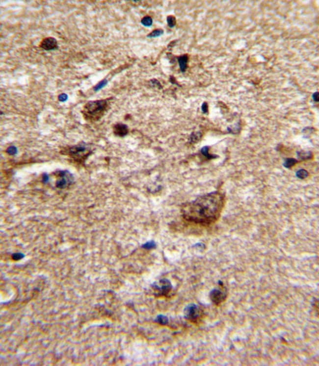 ADRA1B Polyclonal Antibody, 100 µg