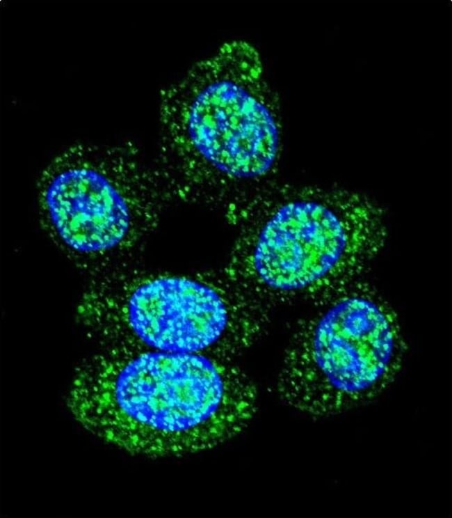 ACP1 Polyclonal Antibody, 100 µg