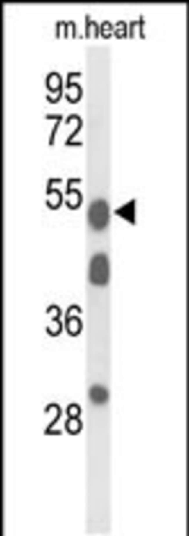 A1BG Polyclonal Antibody, 100 µg