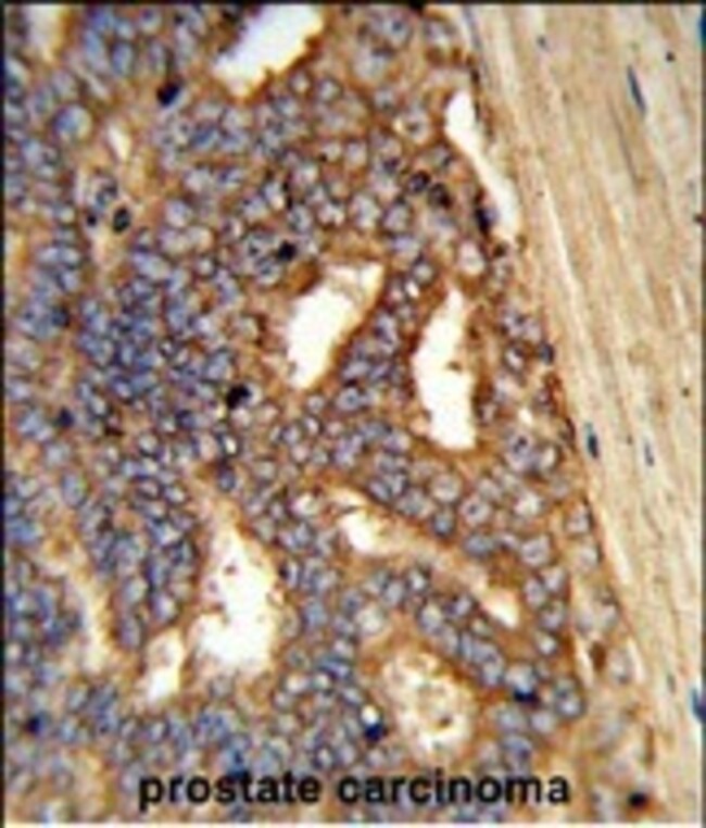 AMY1A Polyclonal Antibody, 100 µg