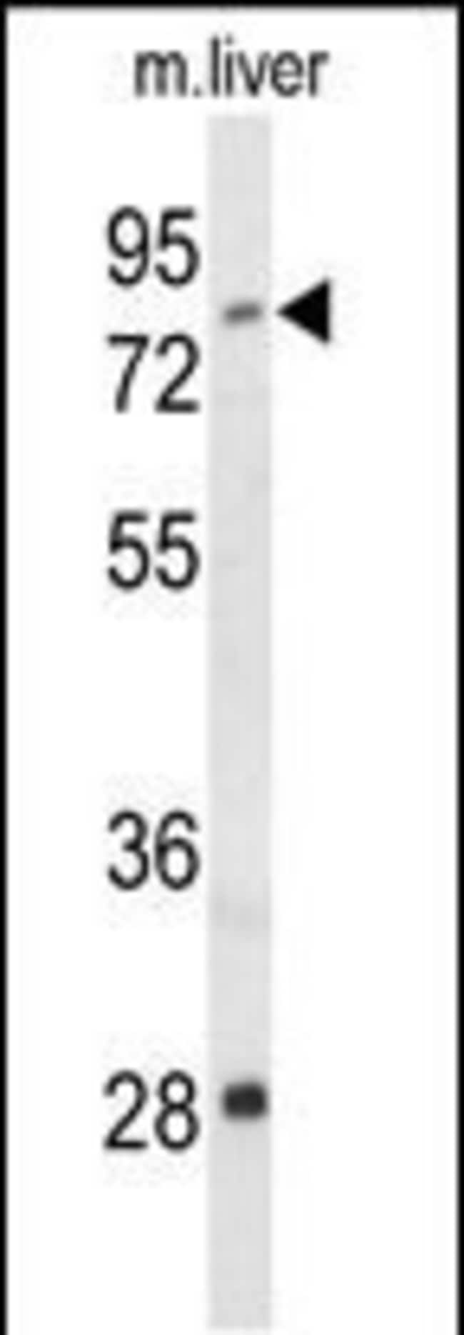 ACSS2 Polyclonal Antibody, 100 µg
