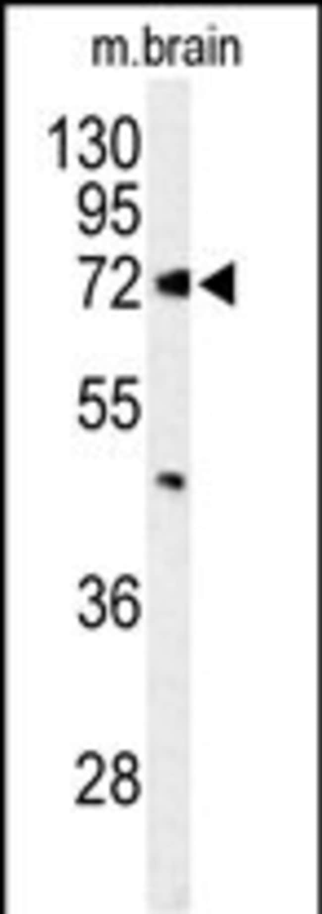 ABCD2 Polyclonal Antibody, 100 µg