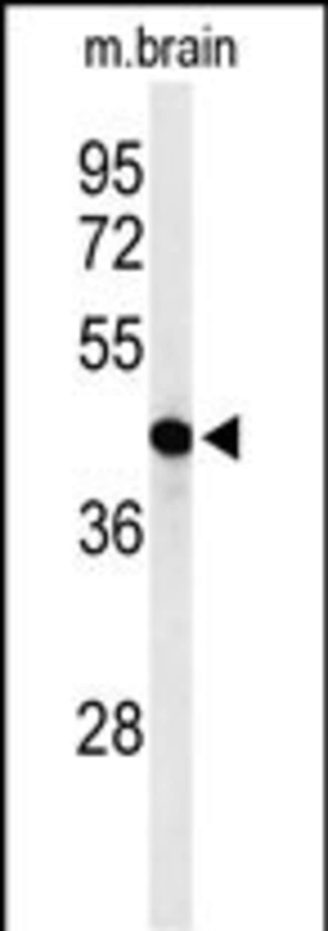 AGPAT6 Polyclonal Antibody, 100 µg