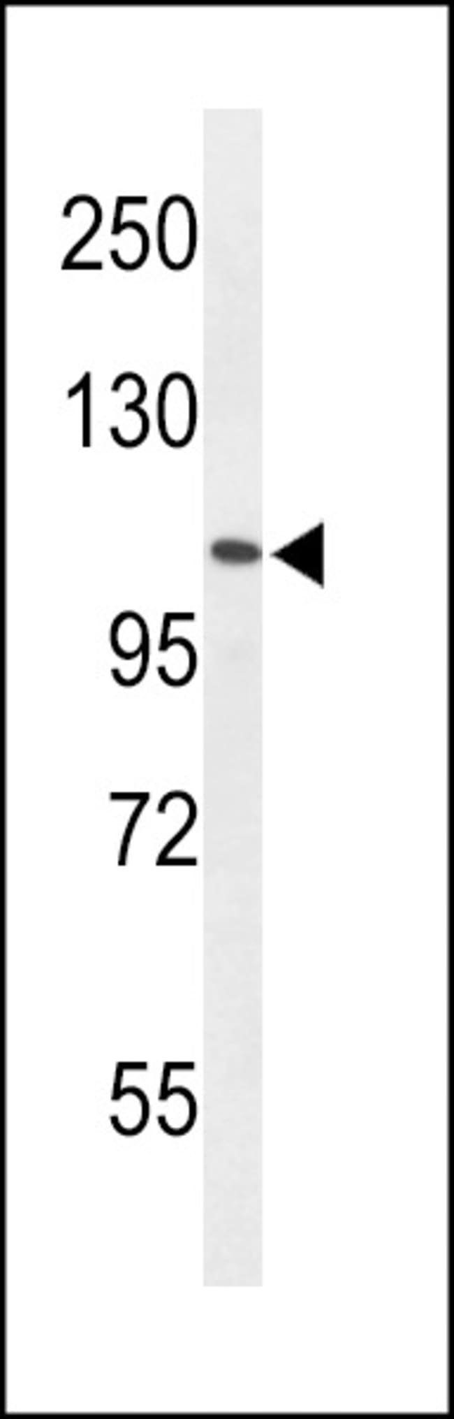 AF5q31 Polyclonal Antibody, 100 µg